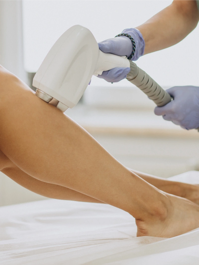 LASERoma Epilazione Laser