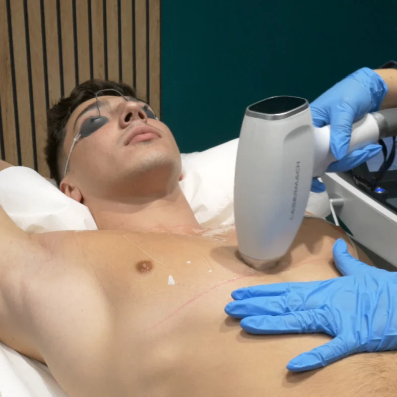 LASERoma Trattamenti Uomo LASERoma Trattamenti Uomo