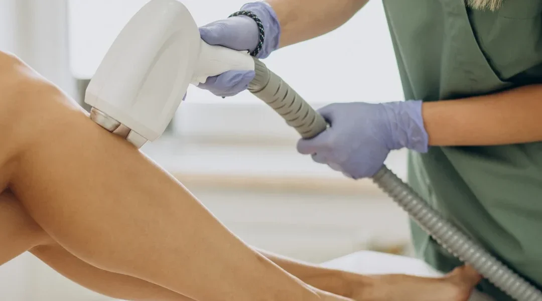 Epilazione Laser per Adolescenti: La Guida Completa per le Mamme