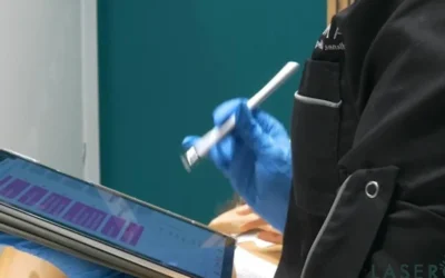 🧨 Perché il tuo laser non sta funzionando: tutti gli orrori (comuni) che rovinano un trattamento efficace